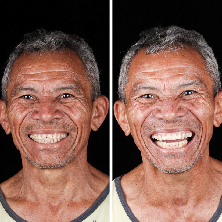 Бразилски зъболекар пътува по света, за да върне усмивките на лицата на бедните хора безплатно