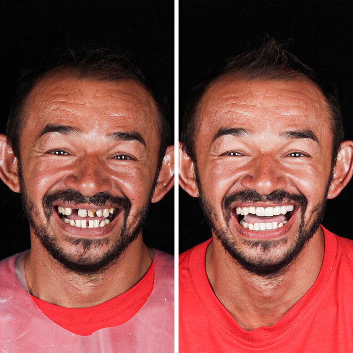 Бразилски зъболекар пътува по света, за да върне усмивките на лицата на бедните хора безплатно