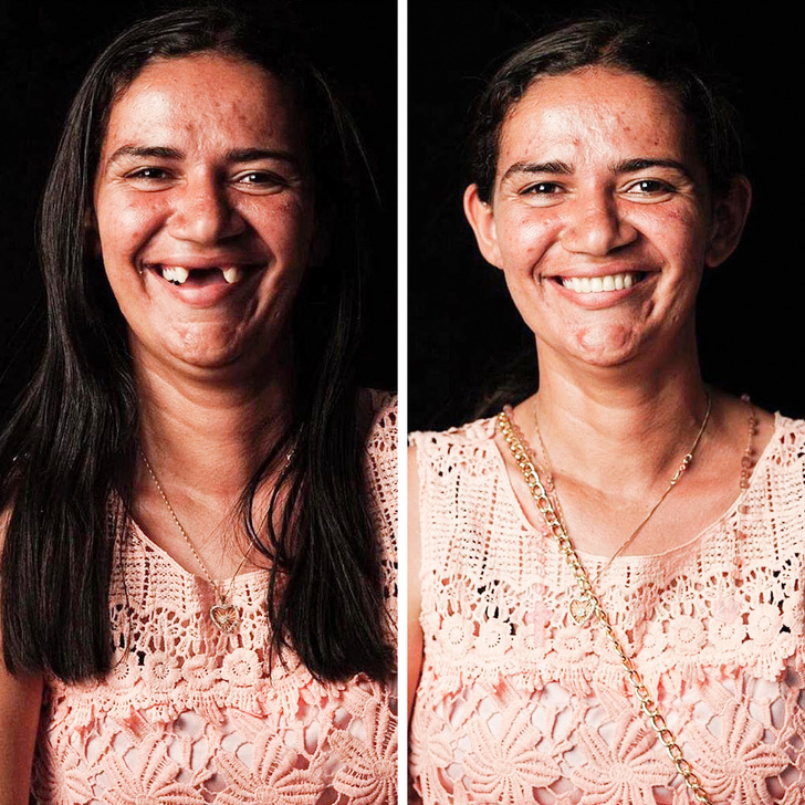 Бразилски зъболекар пътува по света, за да върне усмивките на лицето на бедните хора безплатно