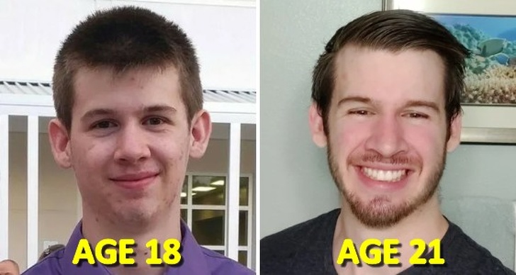 20 Преди и след снимки, показващи хора, които цъфтят като пеперуди