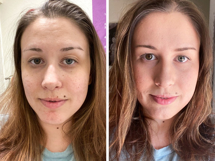 15+ момичета преди и след нанасяне на естествен грим