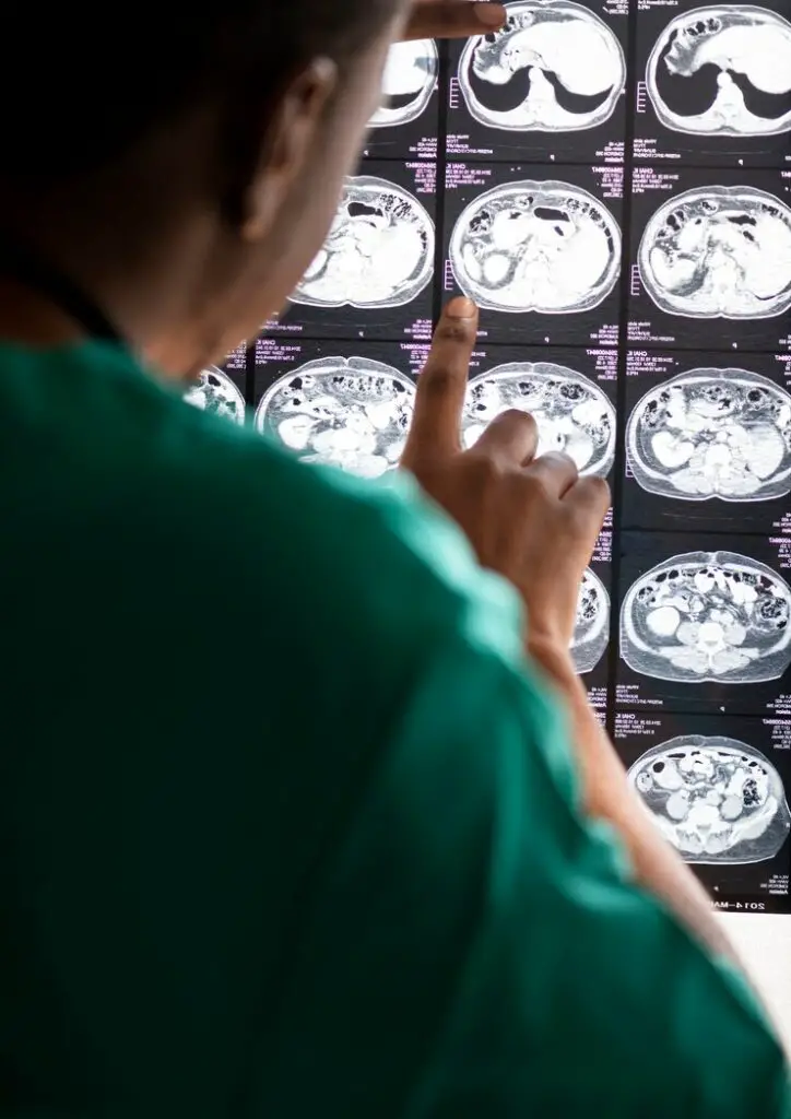 doctor-reading-brain-mri-x-ray-result_53876-13389-724x1024
